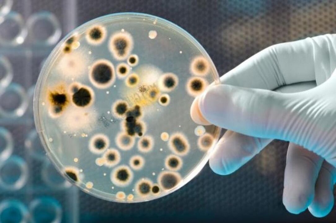 fertőző prosztatagyulladást okozó baktériumok